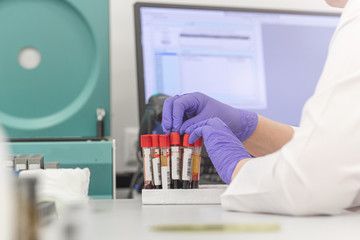 blood plasma tubes, laboratory assistant hands holding test tubes, blood test