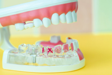 Transparent silicone model of the human jaw with a pin, a practical plastic manual for nurses,...