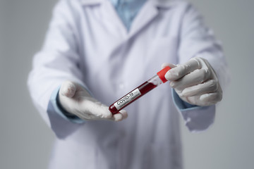 Hand of a doctor holding test tube with blood for Covid-19 (coronavirus) analyzing. Laboratory testing patient’s blood