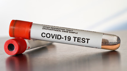 Coronavirus test concept - vial sample tube with cotton swab, another container in background, closeup detail. (Sticker is own design with dummy data, not real product)