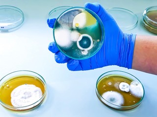 Malt Extract Agar in Petri dish using for growth media to isolate and cultivate yeasts, molds and fungal testing from clinical samples, hold in scientist hand in medical health laboratory.