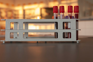 Blood tubes in a rack on table in intensive care unit in hospital. The end  of the night shift,...