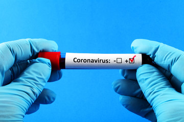 Coronavirus. Doctor's hand in a blue glove. Blood sample in vitro for analysis. Blue background.
