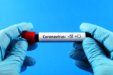 Obraz premium Coronavirus. Doctor's hand in a blue glove. Blood sample in vitro for analysis. Blue background.
