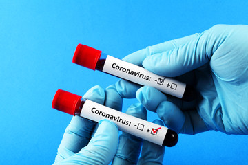 Fototapeta premium Coronavirus. Doctor's hand in a blue glove. Blood sample in vitro for analysis. Blue background.