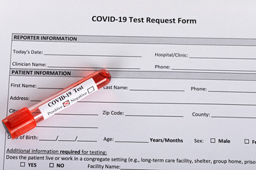 Obraz premium Covid-19 blood test