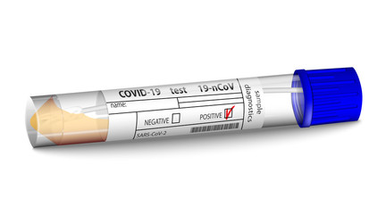 Test Tube with Coronavirus 2019-nCoV swab Sample. Positive blood test result for Covid 19 virus, originating in Wuhan, China. Realistic Isolated on a white background.