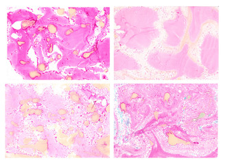 Set of abstract backgrounds with pink stains and spots.