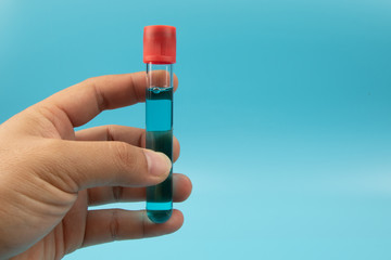 Hand with holding Medical test tube with blue liquid on white background