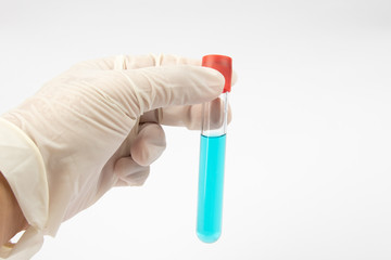 Hand with medical glove holding Medical test tube with blue liquid on white background