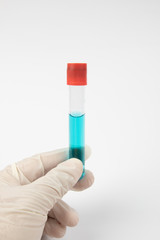 Hand with medical glove holding Medical test tube with blue liquid on white background