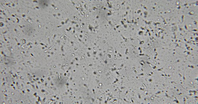 Human semen in phase contrast microscope