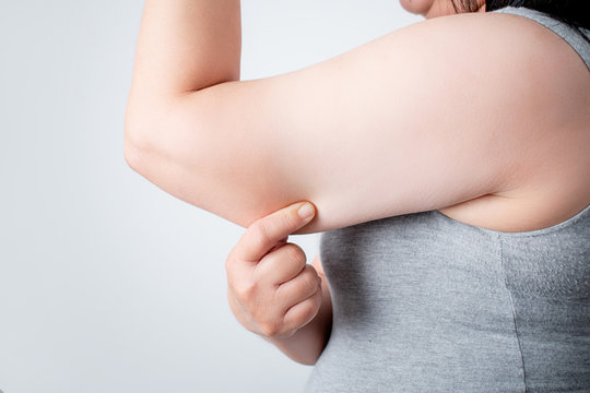 Excess fat under the arms of women who are overweight. Health care workers.
