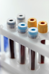 medicine, healthcare and pandemic concept - close up of beakers with coronavirus blood test in holder at laboratory