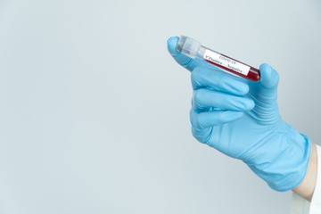 Obraz premium Woman's blue-gloved hand holds a test tube of blood with a positive result for COVID-19 with a copy space. Concept of medicine, analysis.