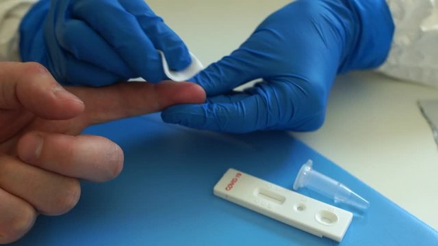 Blood sampling for analysis on coronovirus covid-19. Test cassette for virus detection. Express test covid 19