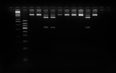 PCR band on agarose gel using  by molecular technique. Molecular analysis