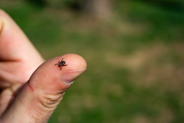 tick on human skin on the background of the forest