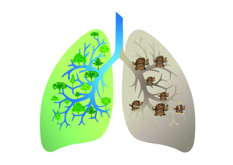 Deforestation effect. green lung with abnormal lung vector