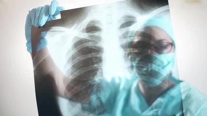 Conceptual video of a doctor holding and analyzing an x-ray of some lungs.