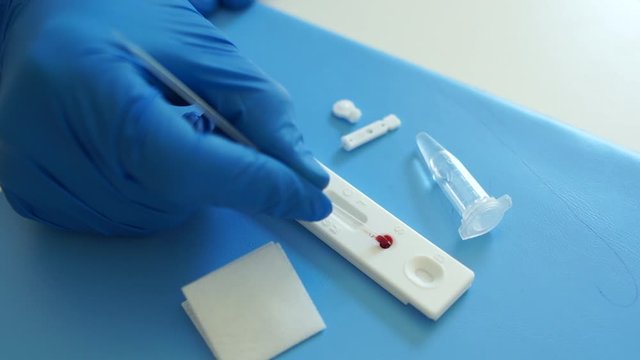 Kit for carrying out express diagnostics on coronovirus covid-19. Mixing a blood sample and reagents into a test cassette. Negative result
