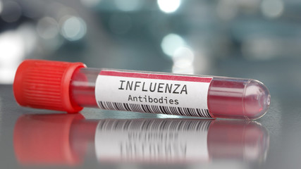 Influenza antibodies in medical lab