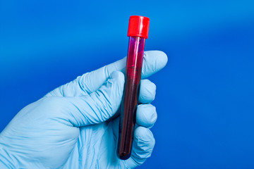 Hands in rubber gloves holding blood in test tube close up