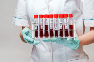 medical doctor nurse woman wearing protective mask and gloves - holding rack with virus blood tests
