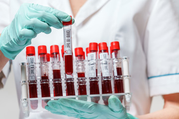 medical doctor nurse woman wearing protective mask and gloves - holding rack with virus blood tests