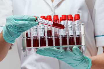 medical doctor nurse woman wearing protective mask and gloves - holding rack with virus blood tests