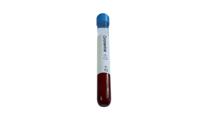 Coronavirus blood test tube, covid-19 positive result blood sample. 3d Rendering.