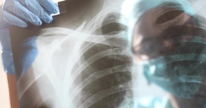 Conceptual video of a doctor holding and analyzing an x-ray of some lungs.