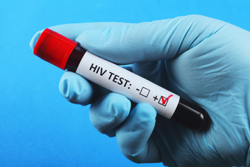 Obraz premium Vacuum test tube with blood in the doctor's hand. blood test for hepatitis. Blue background.
