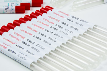 écouvillons, test Coronavirus - Covid 19