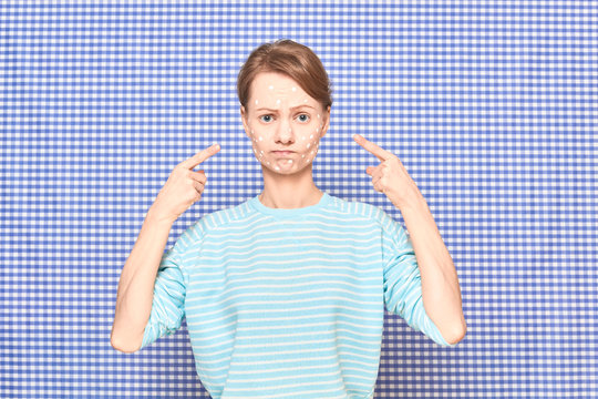Portrait of unhappyl girl pointing at white spots of cosmetic on face