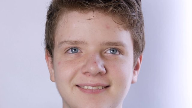 A cute teen boy with blond hair and blue eyes with problem skin and teenage acne is looking at the camera on a white background. Dermatological problems in a teenager. Young guy in a transitional age.