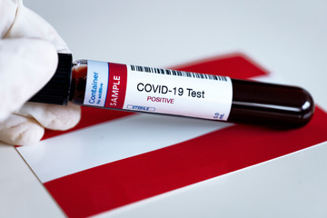 Testing for presence of coronavirus in Austria. Tube containing a blood sample that has tested...