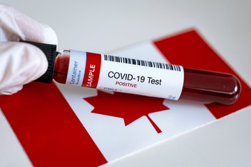 Testing for presence of coronavirus in Canada. Tube containing a blood sample that has tested positive for COVID-19. Canadian flag in the background.