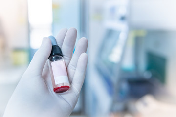Close up of Hand wearing glove holding a Dropper Bottle blood test with blurred background, medical research lab and science laboratory concept.