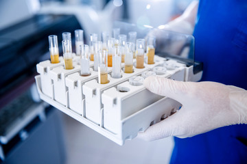 Express analysis of human urine in medical laboratory. Lab technician holds test tube setup