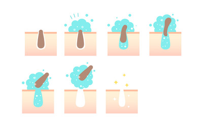 毛穴の汚れ（角栓）をクレイジング泡がすっきりとりのぞいて綺麗になった肌のイラスト・美容