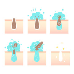 毛穴の汚れ（角栓）を筋肉もりもりなクレイジング泡がすっきりとりのぞいて綺麗になった肌のイラスト（擬人化）