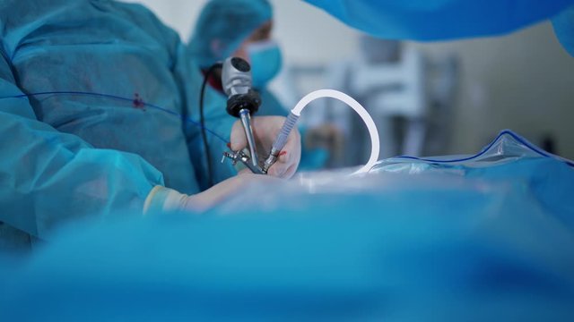 Modern medical device in surgeon's hands during surgery. Specialist conducting an operation on kidneys to a patient. Close-up.