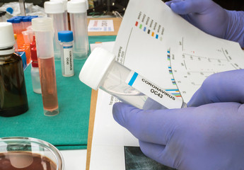 Scientist studies the curves of the Covic-19 pandemic and the dna of an infected person, holding a sample vial in a hospital, Spain, conceptual image
