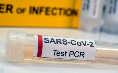 Vial pcr of SarsCov2 coronavirus, conceptual image