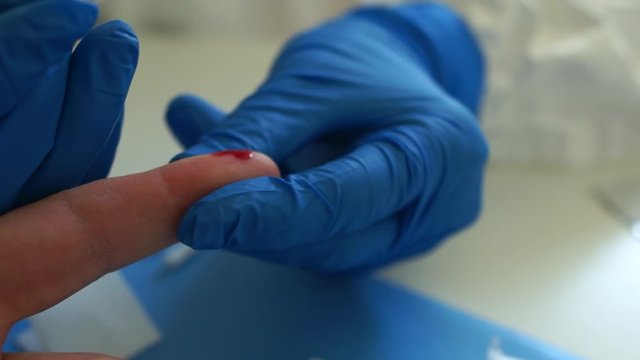 Rapid test covid 19. Serological blood test. Close-up blood sampling for analysis on coronovirus covid-19. Test cassette for determination of the virus SARS-CoV-2