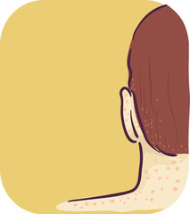Symptom Head Neck Red Bump Lice Bites Illustration