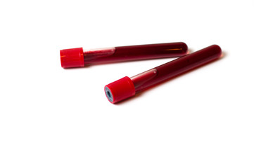 Two test tubes with blood isolate on a white background. The concept of medicine, the fight against viruses and bacteria, diseases