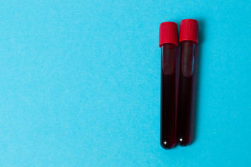 Two test tubes with blood isolate on blue background. The concept of medicine, the fight against viruses and bacteria, diseases