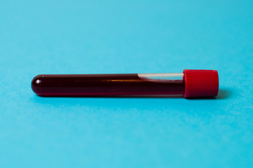 Test tube with blood isolate on a blue background